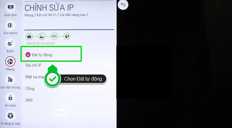 Cài đặt IP tự động